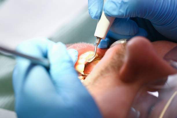 Best Orthodontic Emergency Dentist in Lake Royale, NC