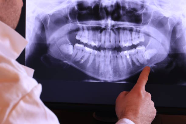 Best Mobile Emergency Dentist in Lake Royale, NC
