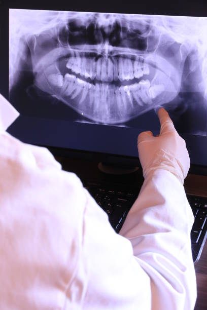 Best Emergency Dentist for Knocked-Out Tooth in Lake Royale, NC